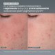 Daily Microfoliant 